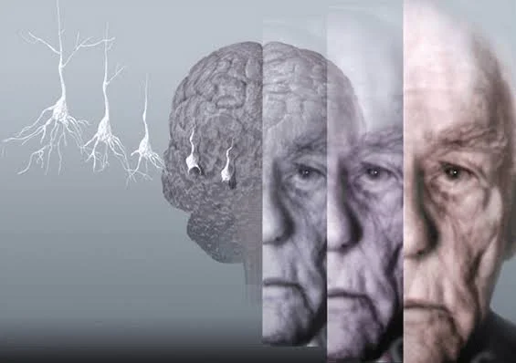 Descubren cómo frenar el deterioro motriz en el cerebro