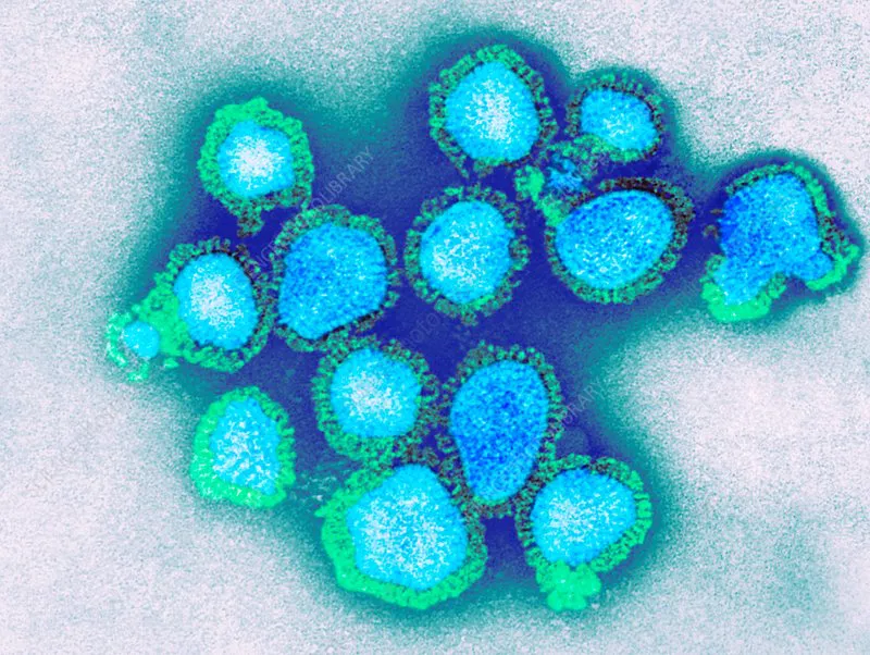 Influenza A(H3N2)